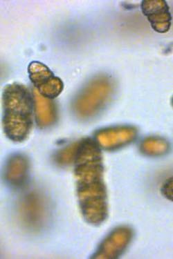 A photomicrograph of cells of the bloom-forming dinoflagellate <em>Margalefidinium polykrikoides</em>. © Dr. Kim Reece/VIMS.